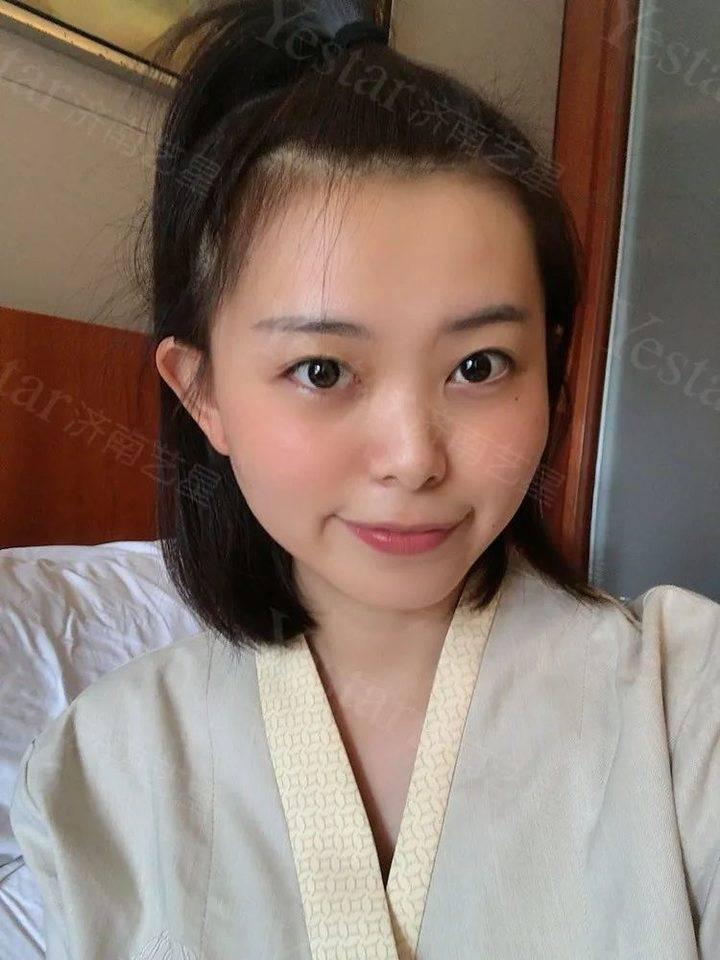 女子鼻子整容七次成C形，坎坷经历引发整容反思