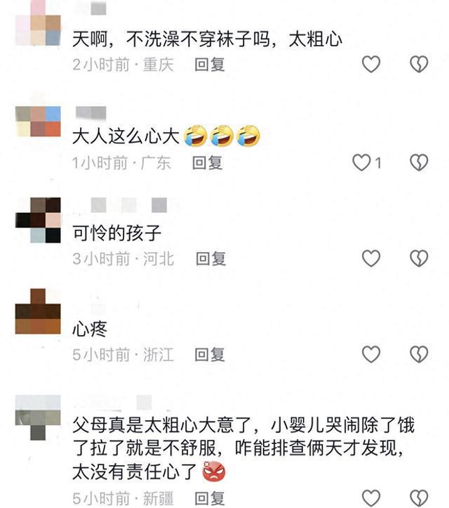 女婴哭闹不止背后的秘密，头发绕脚趾引发启示